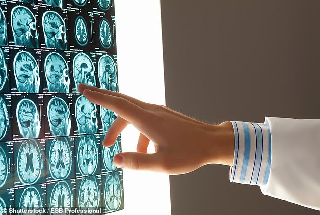 85788683 14622431 Us Researchers Analysed Over 20 000 Adults Over 50 To Estimate T A 18 174490180185.jpeg