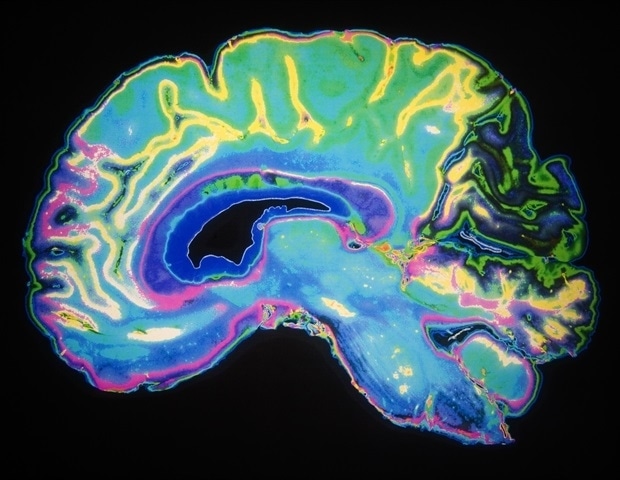 Artificially Colored Mri Scan Of Human Brain Daisy Daisy A8c5d8bbbf824bc8932308e30187510f 620x480.jp .jpeg