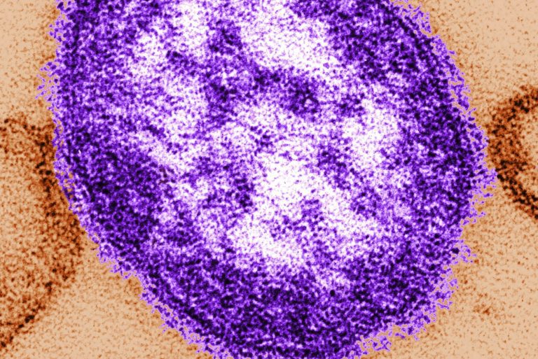 Measles Explainer 56497 Scaled E1748123740649.jpg