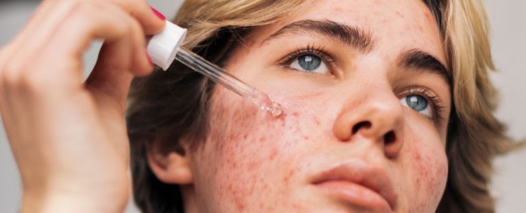 Retinol Skin 1.jpg
